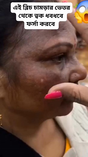 1.3M views · 5.1K reactions | এই ব্লিচ চামড়ার ভেতর থেকে ত্বক ধবধবে ফর্সা করবে #reels #beauty #cute #everyone #viral #naturalskin #love #fypシ #fbreels #tips #forsha #fb | Organic Tips by Rima | Facebook