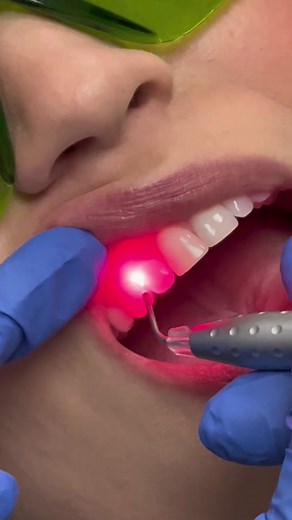 Revolutionize Your Smile with Laser Dentistry