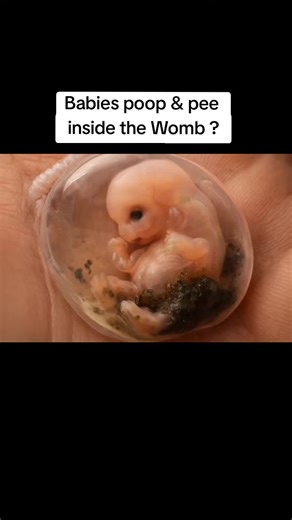 babies poop & pee inside the Womb #babiespoop #babiespeeinginwomb #viraltiktokvideo #babyinwomb