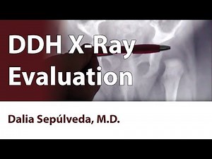 DDH X-Ray Evaluation