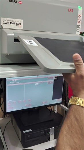 How to Take X-Ray in Agfa CR 10-X | Full CR Cassette to Image Workflow ⚡