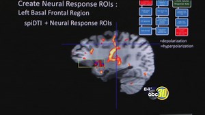 New Epilepsy Treatment