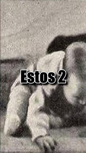 El Cruel Experimento del Bebé Albert #ciencia #curiosidades #historia #shorts