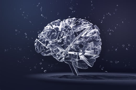 Sintomas de AVC: saiba sinais iniciais que podem passar despercebidos