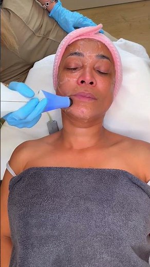 Watch Exilis work its magic for tighter, glowing skin!
