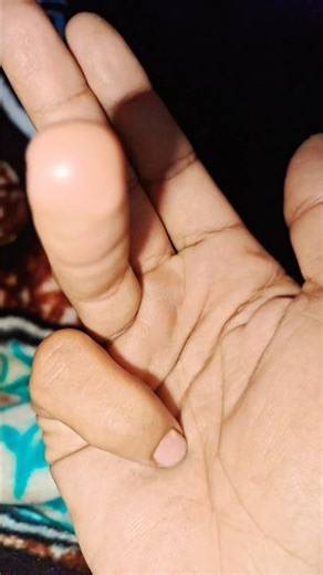 It is the Smaller shiny jewel beetle part2#beau#shrots #trending