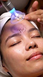 POV Spa Treatment: Forehead Center Clearing with Transparent Pore Vacuum | Realistic Micro-Detail