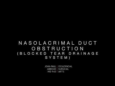 Evaluation of a Blocked Tear Drainage System (Nasolacrimal Duct Obstruction)
