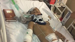 77K views · 316 shares | Jahfari Martin nearly died when he was hit by a car. Surgeons at Southampton General Hospital had to cut open his skull to allow his brain to recover from injury. The remarkable bit is what they did next in a procedure they perform on children only a handful of times each year. To relieve pressure on Jahfari's brain, they cut a section out of his skull, and stored the pieces of bone in his abdomen. James Ingham has the story. | BBC Hampshire & Isle of Wight | Facebook