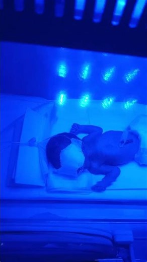 👶 Premature Baby NNJ Treatment | Phototherapy & Incubator Care | NICU Male Nurse Professional Care