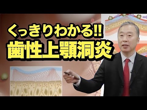 【歯性上顎洞炎】解剖や原因、難治症例の対応まで解説