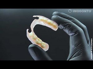 COMO FAZER UMA PRÓTESE FLEXÍVEL