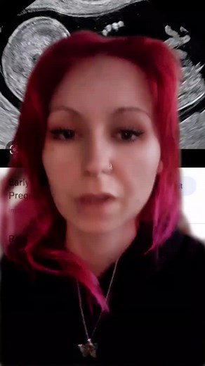 Understanding Anencephaly: Causes, Risks, and Choices