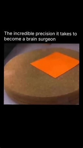 𝗜𝗻𝗳𝗼𝗿𝗺𝗮𝘁𝗶𝗼𝗻 & 𝗞𝗻𝗼𝘄𝗹𝗲𝗱𝗴𝗲 on Instagram: "Robotic surgery systems like the da Vinci robot represent a new era of medical precision. Using high-definition cameras and ultra-precise robotic arms, they allow surgeons to perform complex procedures through tiny incisions with unmatched control and steadiness. The result? Less pain, minimal blood loss, and faster recovery for patients. It’s where advanced robotics meets human expertise — turning surgery into something as exact as engi