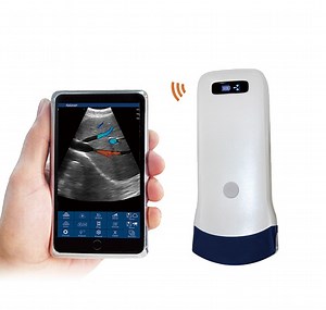 [Hot Item] WiFi Wireless Linear Convex Doppler Ultrasound Probe
