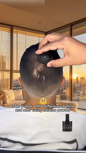 93 reactions · 11 comments | （Worried About Harsh Chemicals on Your Scalp?） Why compromise safety for beauty? Our gentle hairline powder is vegan-friendly and free from irritants, designed for all hair types! It nourishes with keratin while camouflaging thin spots. Plus, low minimums let you test it risk-free. DM us to transform your hair routine today!  #SafeHairCare #VeganBeauty #ScalpFriendly #HairHealth #LowMOQ | Sevichemliyone | Facebook