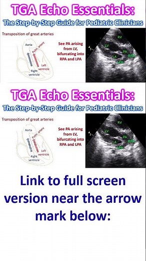 TGA Echo Essentials: The Step-by-Step Guide for Pediatric Clinicians