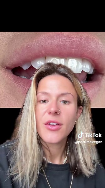 Understanding Missing Tooth Enamel Causes and Solutions