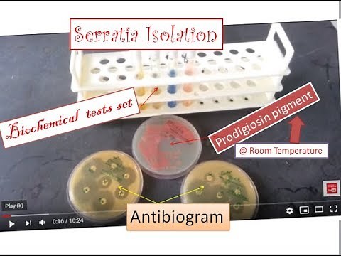 Serratia | the simplest way of identification and isolation from specimens | Serratia marcescens