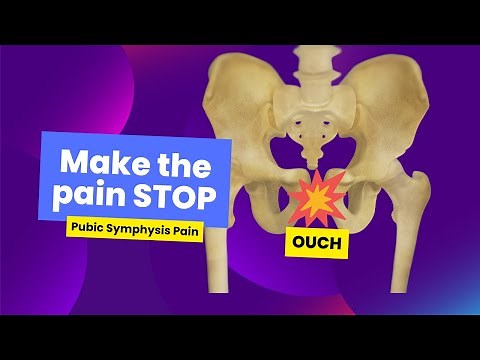Pubic Symphysis Pain and Exercises to Help