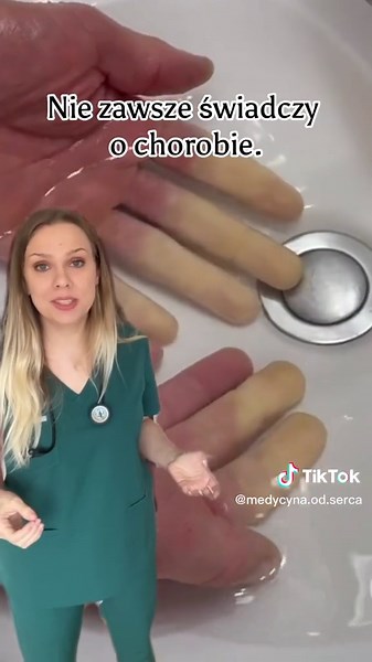 Objaw Raynauda: Co to jest i jakie są możliwe przyczyny?