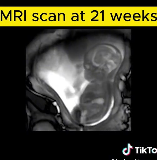Baby Ultra Sound on TikTok
