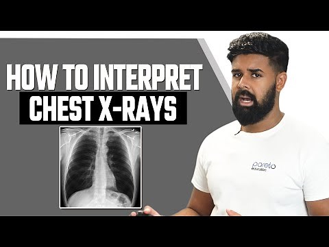 Mastering Chest X-Ray Interpretation: A Step-by-Step Guide | Pareto Education