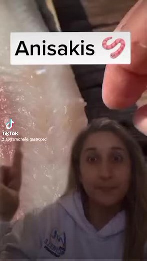 Anisakis: Síntomas, Causas y Prevención | Todo lo Que Debes Saber