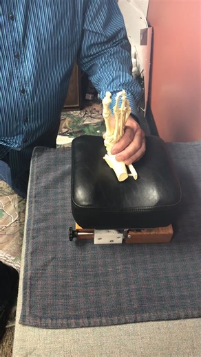 Bunion Protocal on Dry Bones (w) Drop Piece