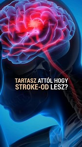 Tartasz attól, hogy stroke-od lesz? 🧠 👉🏻 Foglalj időpontot és bízd rá magad Dr. Márki Sándorra: https://medicall.cc/idopontfoglalas/fibonacciclinic/doctors?doctorId=453316 📲 36 70 409 4453 | 36 70 565 5516 🌐 fibonacciclinic.hu 📍 Szeged, Felső Tisza-part 31–34. „A” lépcsőház, földszint 1. | Fibonacci Clinic