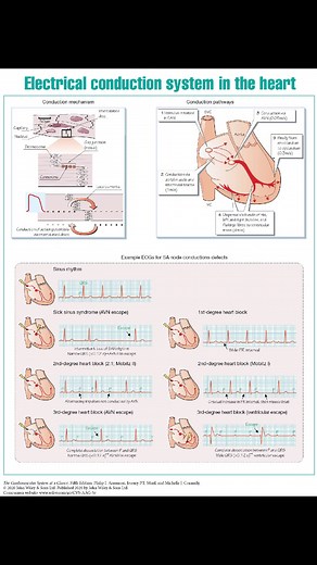 26K views · 276 reactions | Electrical Conduction System of The Heart. #CardiacConduction #Cardiology | Abdallah Othman | Facebook