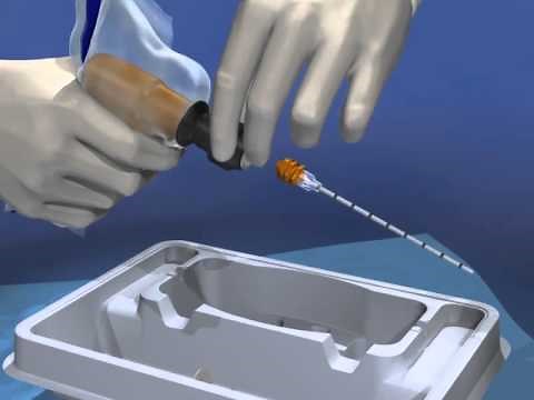Arrow® OnControl® Bone Marrow Aspiration & Biopsy Procedure - MC 001172