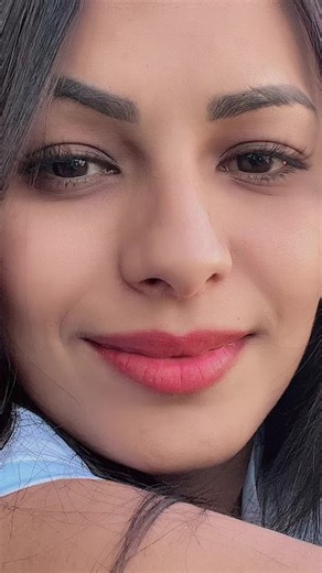 Understanding Bruises: Causes and Concerns