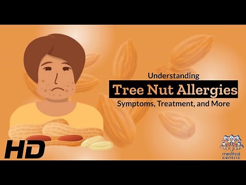 Tree Nut Allergies 101: A Comprehensive Guide to Your Health