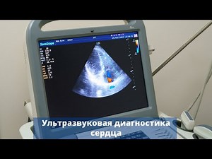 Ультразвуковая диагностика (УЗИ) сердца