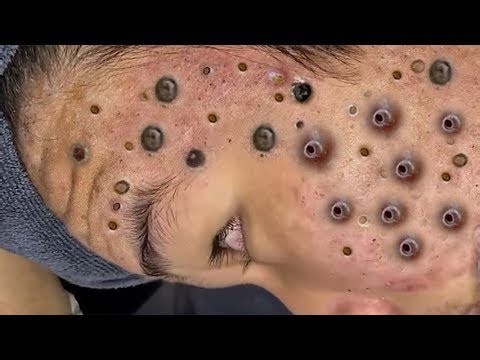 ℝ𝕖𝕝𝕒𝕩𝕚𝕟𝕘 𝕊𝕜𝕚𝕟𝕔𝕒𝕣𝕖 ℝ𝕠𝕦𝕥𝕚𝕟𝕖 ℂ𝕝𝕖𝕒𝕟𝕤𝕚𝕟𝕘 𝔸𝕟𝕕 𝕃𝕚𝕗𝕖 𝕊𝕥𝕠𝕣𝕚𝕖𝕤 𝔻𝕒𝕚𝕝𝕪 #85927