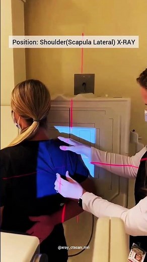 Position-shoulder(Scapula Lateral) x-ray view 🩻 youtube shorts #rediology #medicalimaging #youtube