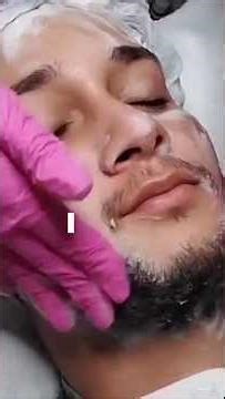 Limpeza de Pele + Peeling Químico! #skincare #hidratação #limpezadepele #viral #facialtrea #botox