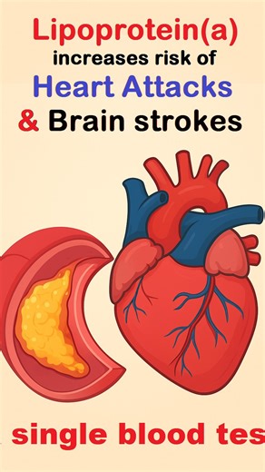 Lipoprotein(a) — the silent cholesterol nobody tests… but everyone should! Normal cholesterol reports can still miss one major risk factor for heart attacks — Lp(a). This special test helps detect genetic risk, early artery blockage, and danger even when LDL looks “normal”. 👉 If you have a family history of heart disease 👉 If someone had a sudden heart attack at young age 👉 If you want complete preventive screening …then getting an Lp(a) test can be a game-changer. Sharing this reel to help s