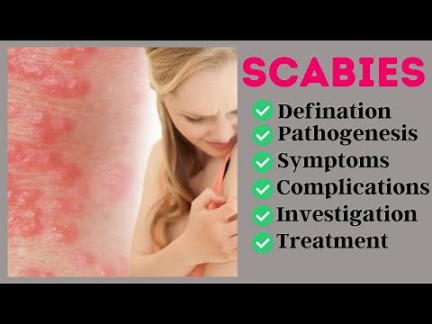 Scabies|Pathogenesis|Symptoms|Complications|Investigation|Treatment|Explain in Detail|