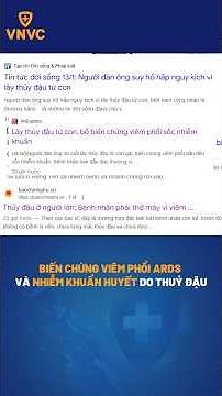 Biến chứng nguy hiểm thuỷ đậu - cảnh báo lây lan trong gia đình