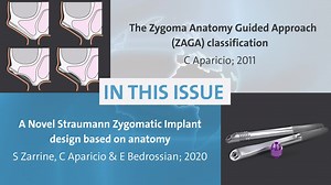 Our latest issue of “Straumann Science Flash” is dedicated to the Straumann® Zygoma Implant System. In this issue: 1. The Zygoma Anatomy-guided approach (ZAGA) classification. C Aparicio; 2011 2. A novel Straumann Zygomatic Implant design based on anatomy. S Zarrine, C Aparicio, & E Bedrossian; 2020 Would you like to know more about the Straumann® Zygoma Implant System? Click here: https://bit.ly/3iHsv3o | Straumann