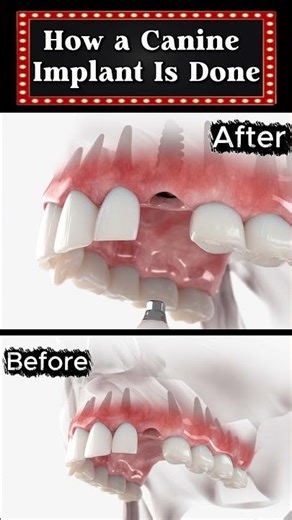 Is the process of getting a dental implant painful?