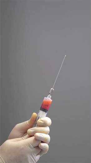 Refresh Your Eyes with Under-Eye Fat Injection! #Shorts #UnderEyeFatTransfer