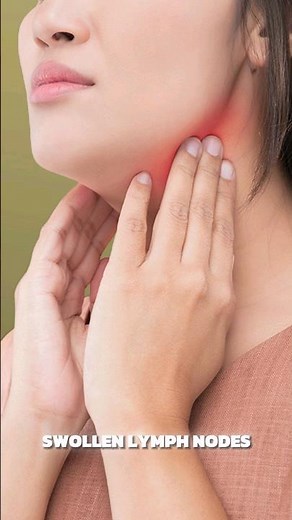 Strep Throat Home Remedies