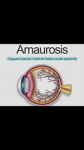 Fenitoína Efectos adversos#farmacologia #farmacia #farmacologia #medicina #medico #medicina
