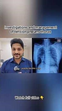 Investigations and management of tension pneumothorax explained #inicet #neetpg2026 #surgerylecture