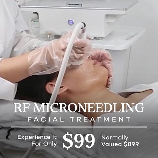 👋 Houston Ladies! Ready to Smooth, Brighten & Glow for the Holidays? 💕 Say goodbye to acne scars, dark spots, and dull skin with our RF Microneedling Treatment — the advanced, non-surgical way to smooth texture, even tone, and restore radiant, youthful skin with minimal downtime! 🌟 For a limited time, get your RF Microneedling Treatment for just $99 (Reg. $899) — that’s $800 OFF for the first 20 new clients! Using radiofrequency and microneedling technology, this treatment helps: 🔹 Fade acne
