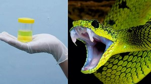Snake urine holds the answer to your kidney stone suffering: A breakthrough crystal discovery that could transform treatment