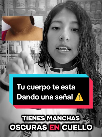 ¿Tienes manchas oscuras en el cuello, axilas o codos? 🚨 Podría ser acantosis nigricans… y estar relacionada con la resistencia a la insulina Tu cuerpo te está dando una señal ⚠️ 📩 Escríbeme al 62476551 para orientarte y cuidar tu salud desde la raíz #resistenciaalainsulina #acantosisnigricans #buenoshabitos #suplementosBolivia #vidasaludable